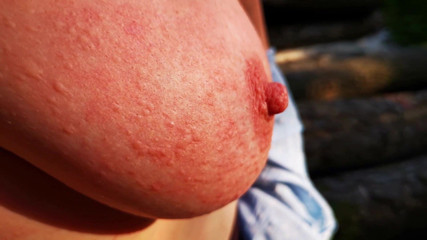 Nettle Punishment Day - Ass, Tits and Vagina in Outdoors - Dc