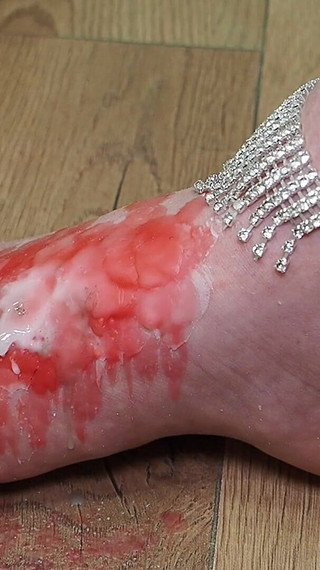 Fire of Hurt: Worship Through Wax