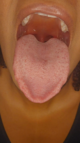 Tongue Teasing Delight