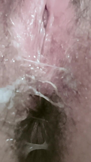 What Happened in My Ass