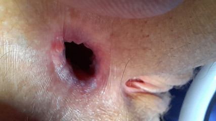 The Great Agape, the Final Outcome